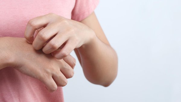 Prévenir et comprendre les piqûres de punaises de lit